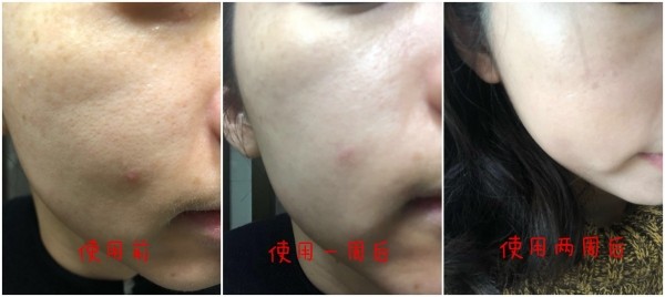 资生堂樱花精华，守护樱花般的粉嫩透白肌！