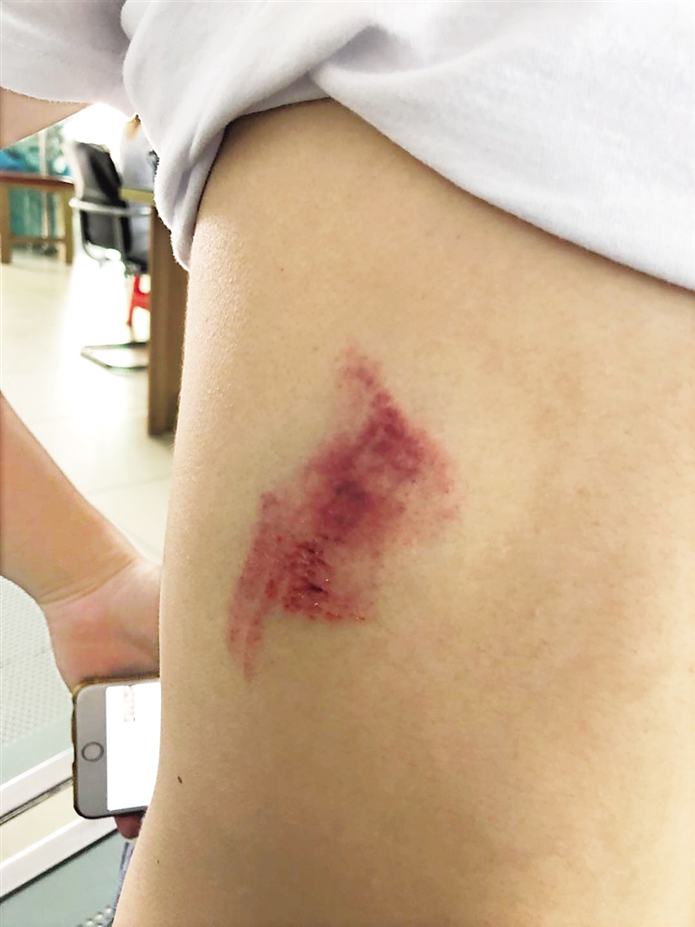 游客去动物园玩儿被动物咬伤事件,游客在动物园被动物咬