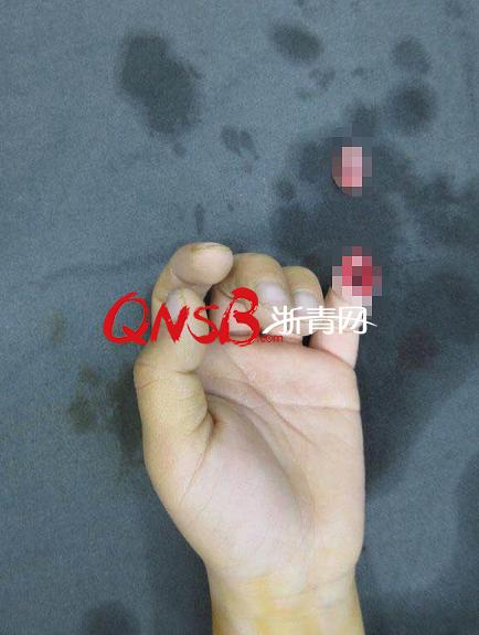 灏忓鎶婅烦缁冲す鍦ㄧ數姊噷鎵嬭鎷夋柇,7宀佺敺瀛╃帺鑰嶆妸鎵嬮敮鏂簡