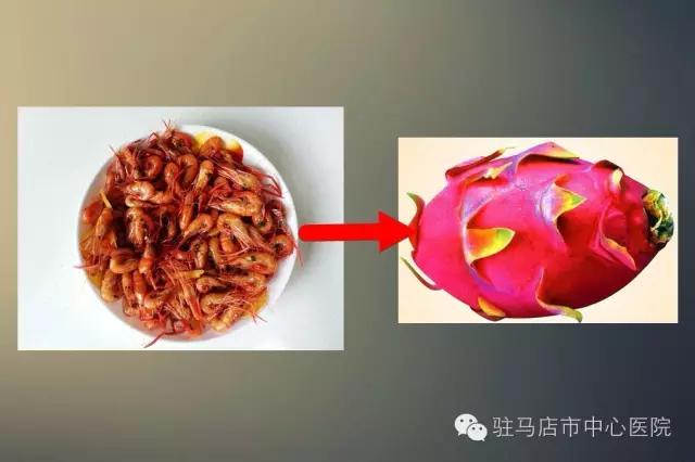他吃了一顿虾，胆囊竟肿成“火龙果”！只因为这种常见病
