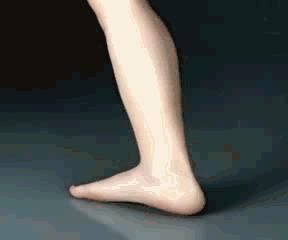 扁平足需要垫足弓吗,扁平足足弓套有用吗