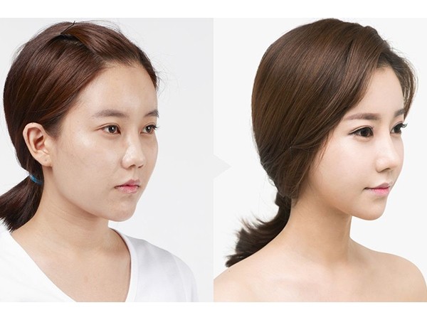 曲线女神不是神话Byphasse与你共同见证更美的自己