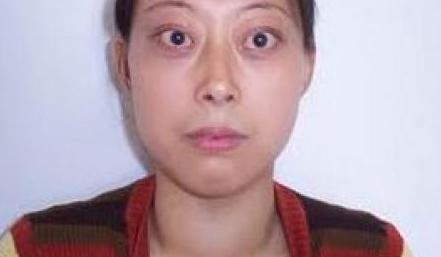 甲状腺疾病民间偏方真相大求真，想快速康复，你该小心了！