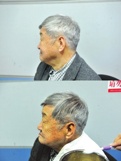 土豆洗头黑发方法,怎么用土豆黑发