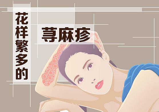 麻疹好了又得了荨麻疹,麻疹需要去医院吗