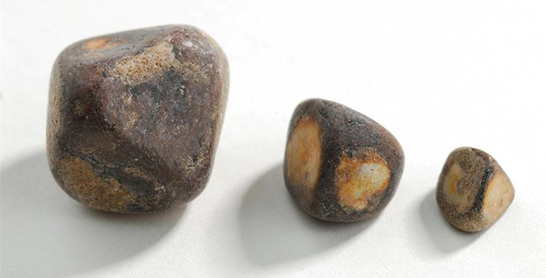 他腹痛发热三天，全身突然变黄，医生只看一眼就明白了！