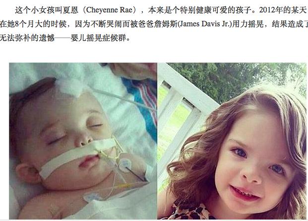 宝宝斜颈该怎么办？这些知识妈妈必须知道！