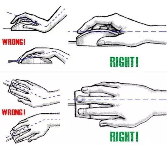 超恐怖，连方向盘都转不动！鼠标手到底怎么回事？