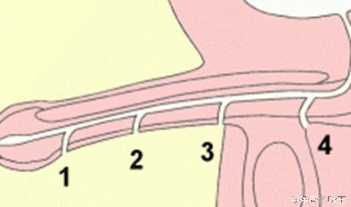 尿道插异物导致发炎,尿道长期插尿管