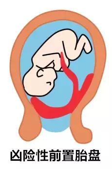 怀孕前必须治好这三种病,怀孕期间会得哪些慢性疾病