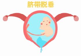 孕妇临产前的几种征兆,孕妇临产前有哪些征兆