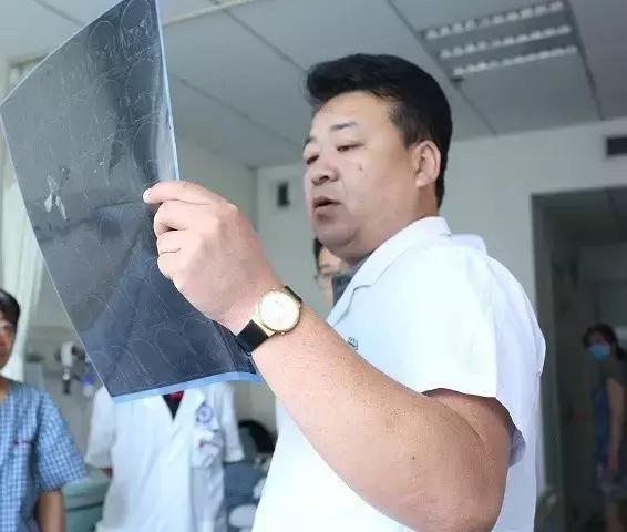 神经外科医生脑膜瘤,神经脑膜瘤