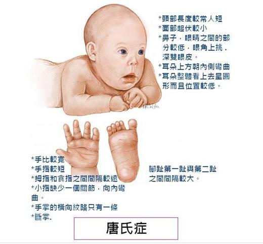 四十岁生二胎风险有多大,生二胎危险性高