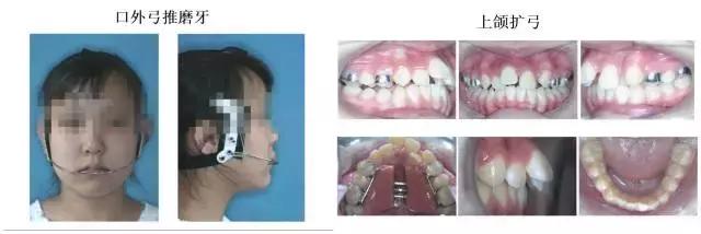 正畸专家介绍图,正畸医生关于整牙的10条建议