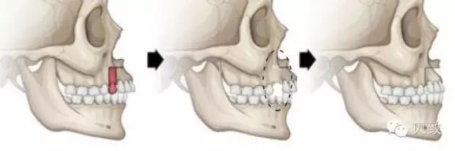 正畸专家介绍图,正畸医生关于整牙的10条建议