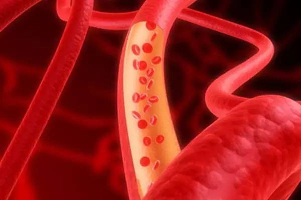 血粘和血稠有什么区别,血粘好治吗