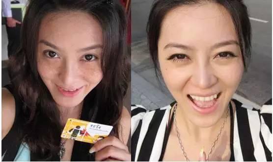 铲除色斑做素颜女神教你祛斑良方,祛斑小妙招知道这些祛斑不踩雷