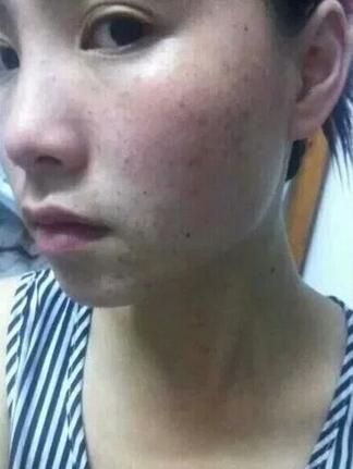 你还在市面上买昂贵的护肤品吗,你还在到处找美白方法和护肤品吗