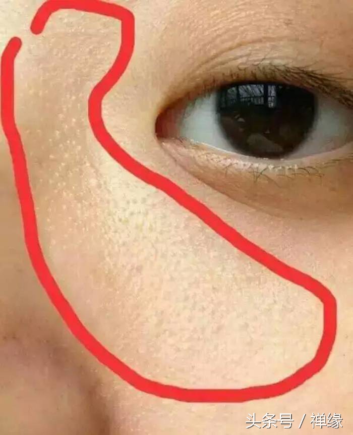 产后皮肤黑了怎么办,产后皮肤暗黄黑怎么调理