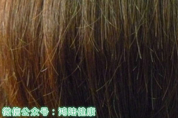 头发枯黄有什么办法让头发变浓密,六个坏习惯让头发悄悄变白