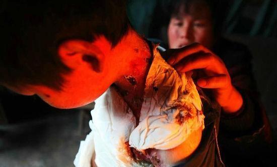 8岁男孩身患怪病,男孩患怪病的真实案例