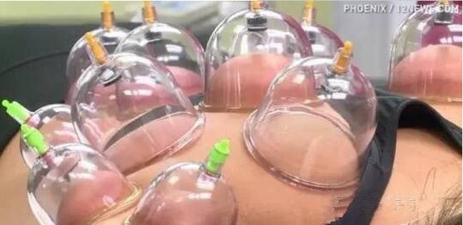 连菲尔普斯都被它征服的东方神器竟然是