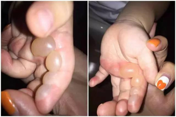 8岁男孩身患怪病,男孩患怪病的真实案例