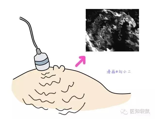 B超三维彩超区别,普通b超能看清胎儿颅内结构吗