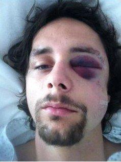 足坛打架最厉害的人,足坛十大冲突排名第一名