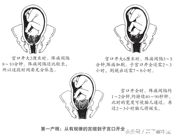 产妇注意了！分娩时生的太快，对新生儿有害！