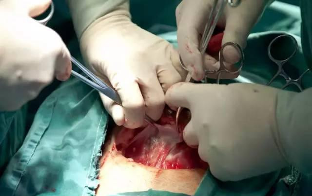 剖腹产轻松,剖腹产其实也是比较好的吧