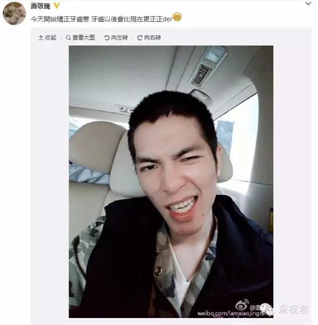 牙齿矫正舌侧牙套经历分享,牙齿矫正隐形牙套真人日记