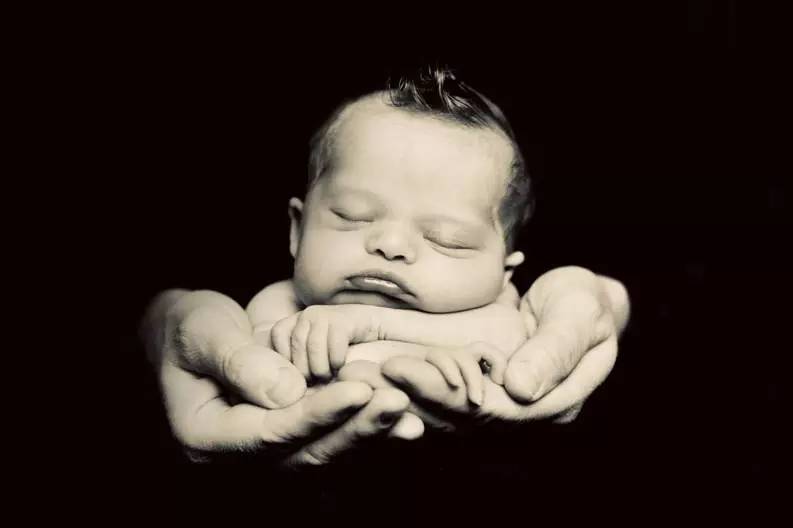 小孩患唐氏综合征,唐氏综合征比较幸运的孩子