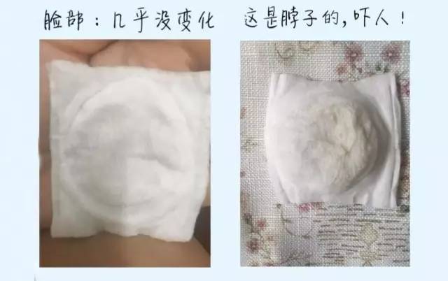 日本日立n4000电子美容仪 (日立n4000使用方法)