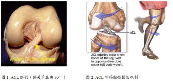 前交叉韧带1-2度损伤能自愈吗,前交叉韧带损伤一年还疼怎么回事