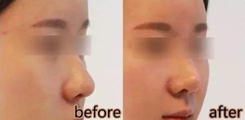 怎样拥有一个光洁的额头,干货的方法和技巧