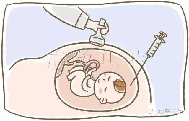 无创跟羊水穿刺哪个安全,绒毛穿刺和羊水穿刺哪个更安全