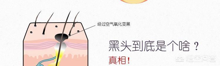 为什么鼻子挤出的白色东西很臭,鼻子上挤出的白色条状物到底是啥