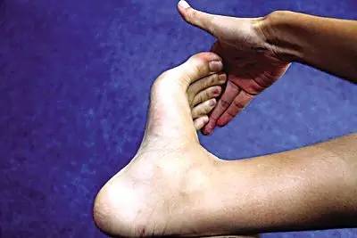 跑步足底筋膜炎后期如何康复训练,足底筋膜炎穿什么鞋跑步