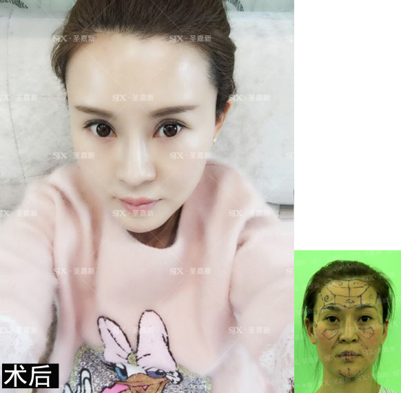 明明才20几岁看着显老,年纪不大看起来显老