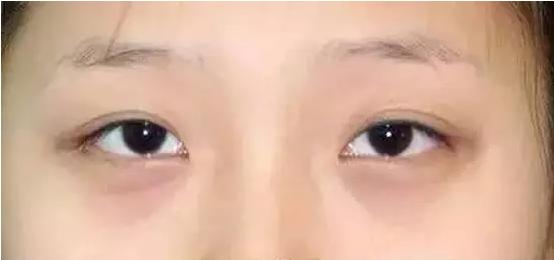 做美瞳线的技巧和方法,教你如何选择美瞳线