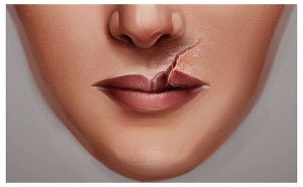 脸上疤痕绘画教程,怎么画雀斑p图