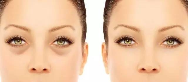 星星眼的小技巧,如何轻松get星星眼