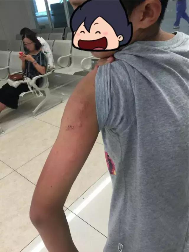 孩子感冒喷嚏不停,孩子感冒咳嗽还频繁打喷嚏