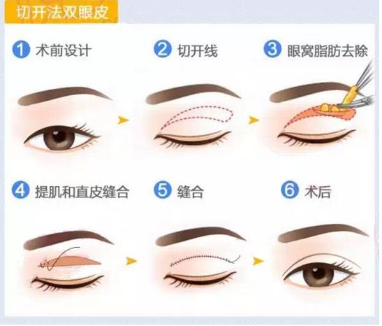 为什么大家都喜欢大眼睛双眼皮,为什么大家喜欢做双眼皮手术