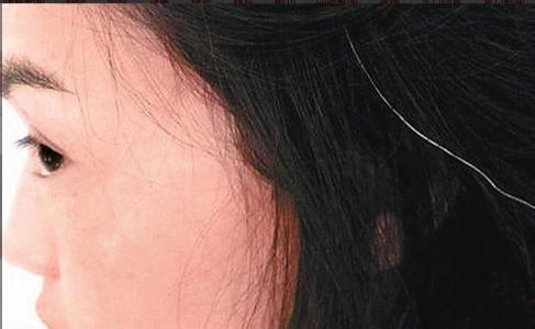 白头发如何变黑食疗,白头发怎样调理才能变黑17岁