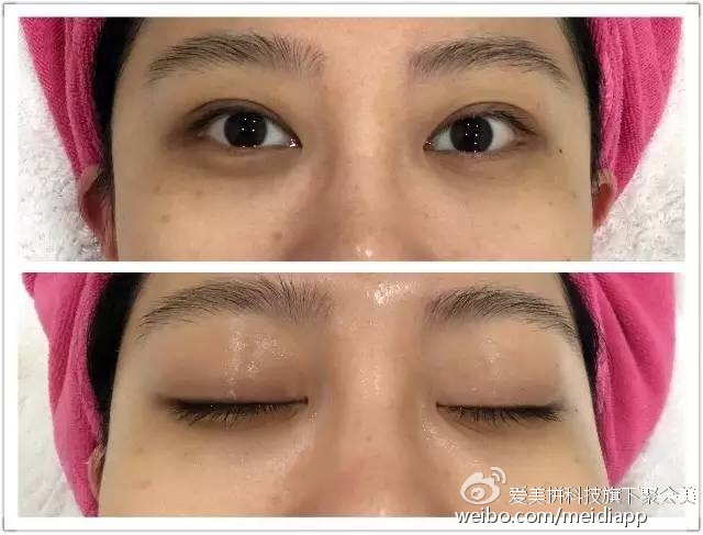 夜猫子如何拯救熬夜肌,如何拯救熬夜