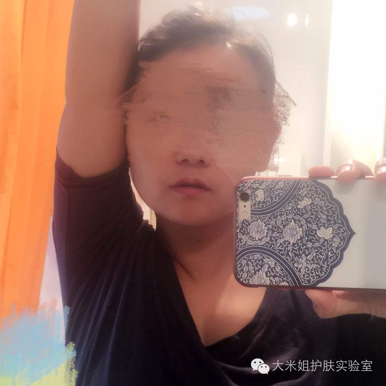 揭秘快速美白祛斑套路,美白祛斑原理