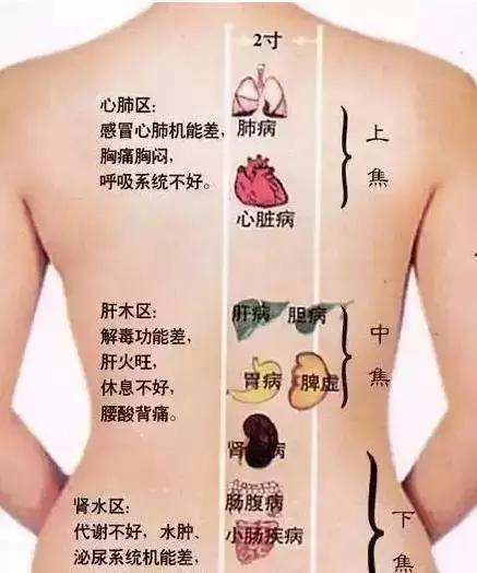 为什么女人会胖在腰部？您知道真相吗？