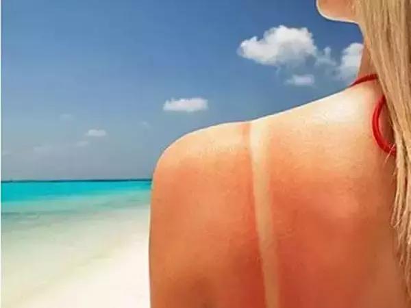 军训晒黑后变白的方法,军训晒黑修复最佳方法